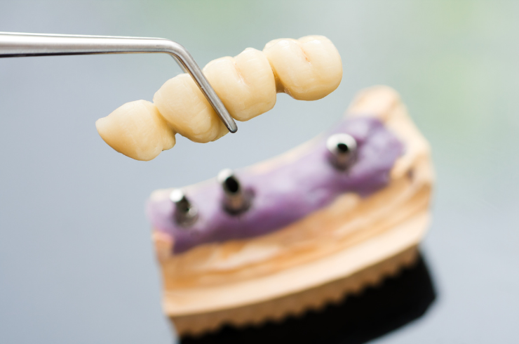 Oral Dental Care