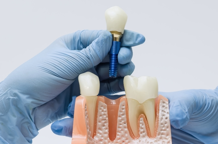 Oral Dental Care