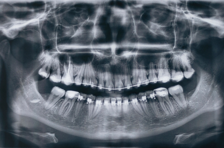 Oral Dental Care