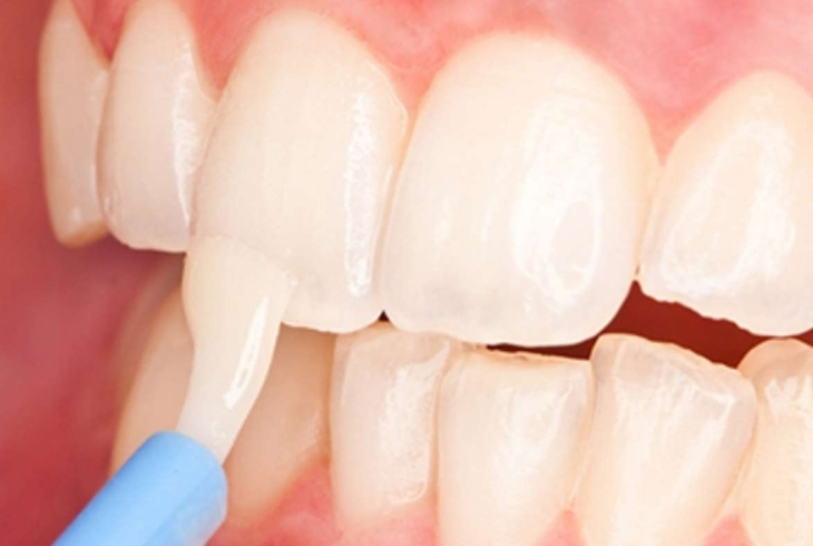 Oral Dental Care