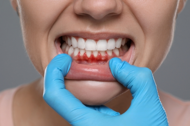 Oral Dental Care