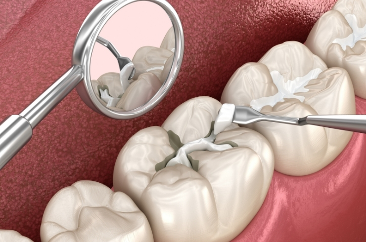 Oral Dental Care
