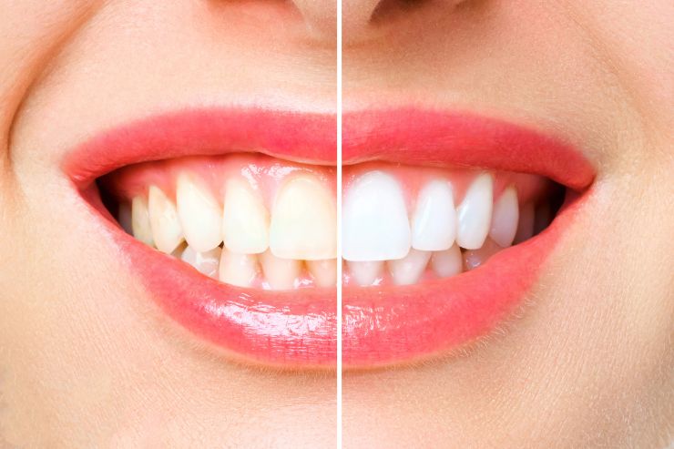 Oral Dental Care