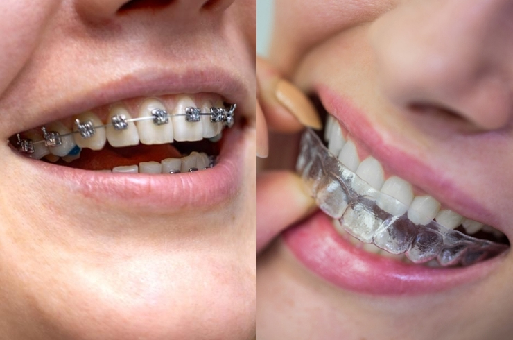 Oral Dental Care