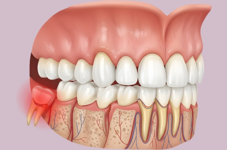 Oral Dental Care